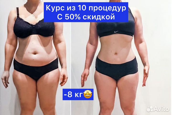 Минус 6 см курс прессотерапии