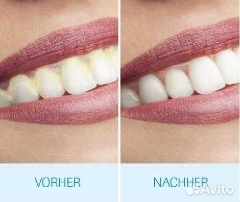 DentaPic Sonic. Набор для чистки зубов