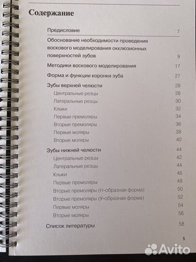 Восковое моделирование