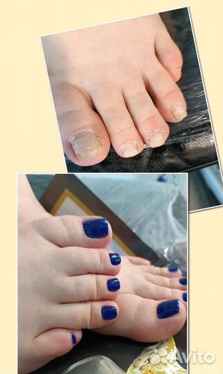 Маникюр, Smart педикюр