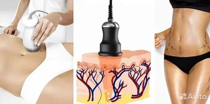 Срочное похудение