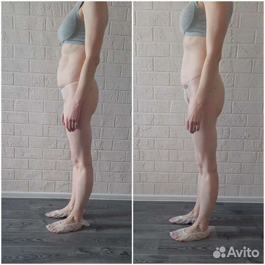 Студия коррекции фигуры