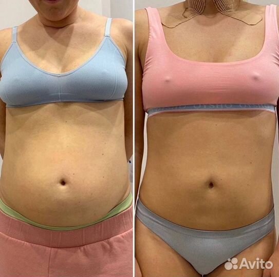 Коррекция фигуры