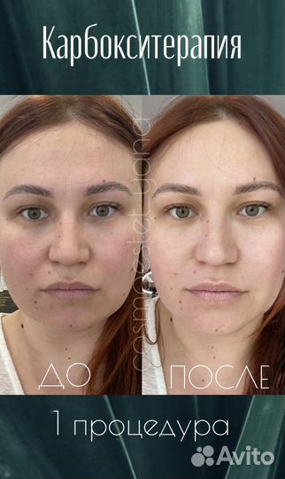 Косметолог Псков