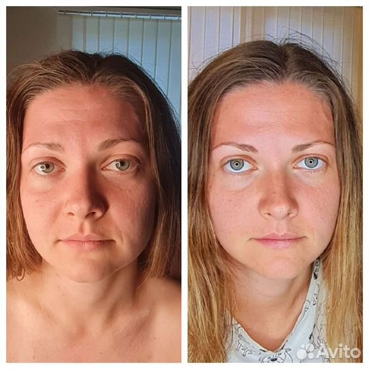 Скульптурно-буккальный массаж лица