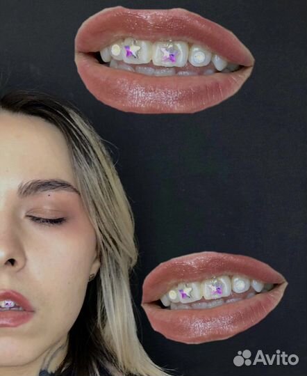 Установка скайсов