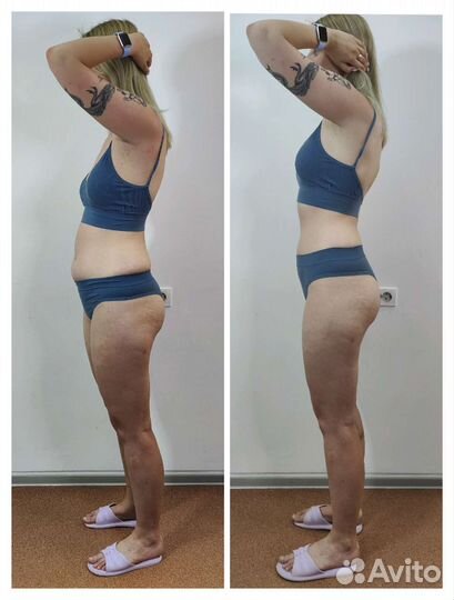 Аппаратный массаж