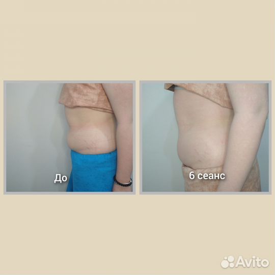 Массаж(общий классич, детский, моделирующий, тейп)