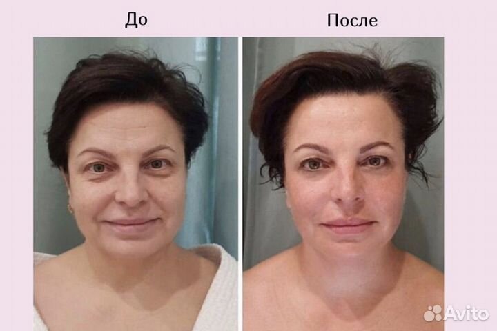 Массаж ручной антицеллюлитный и лимфодренажный