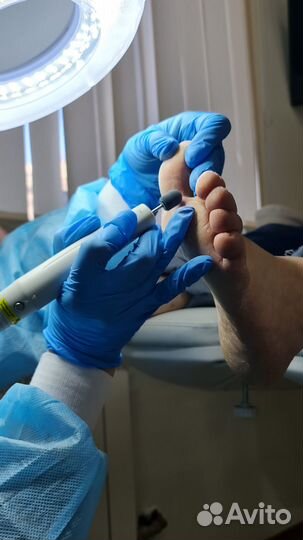 Подолог, медицинский педикюр маникюр