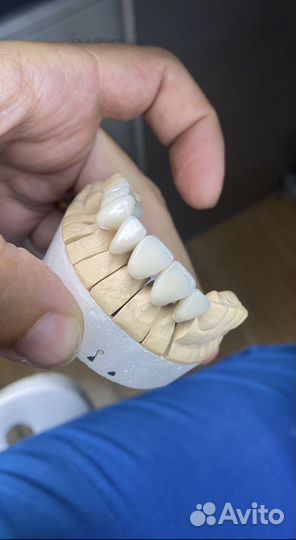 Зубной техник керамист