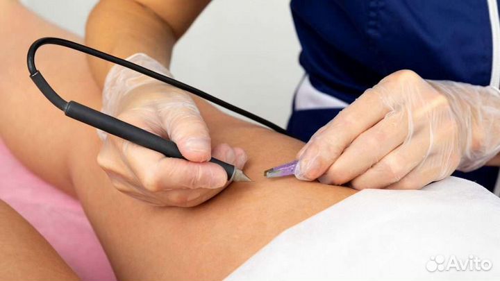 Электроэпиляция: ягодицы