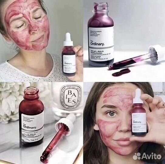 Кислотный пилинг