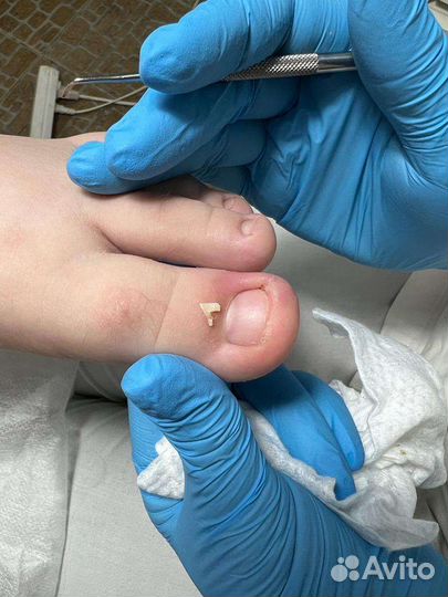 Мастер педикюра подолог