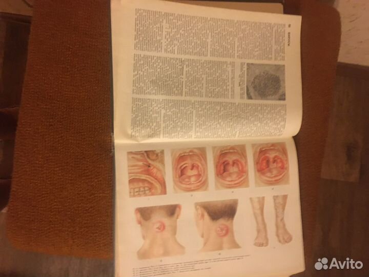 Популярная медицинская энциклопедия