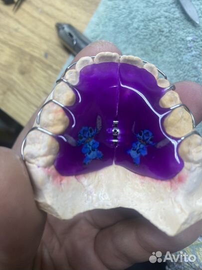 Ортодонтические пластинки