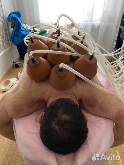 Массаж вакуумный, висцеральный, обучение хиджаме