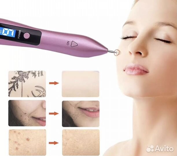 Плазменная ручка