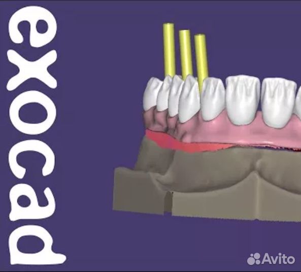 Exocad 8349 (3.1) последняя версия