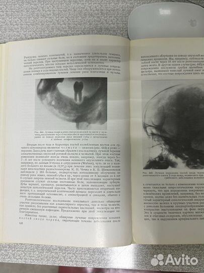 Рентгенодиагностика заболеваний костей и суставов