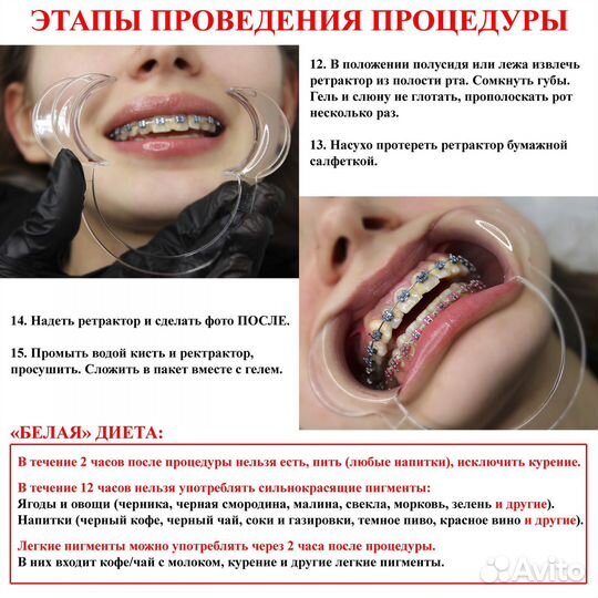 Домашнее отбеливание зубов