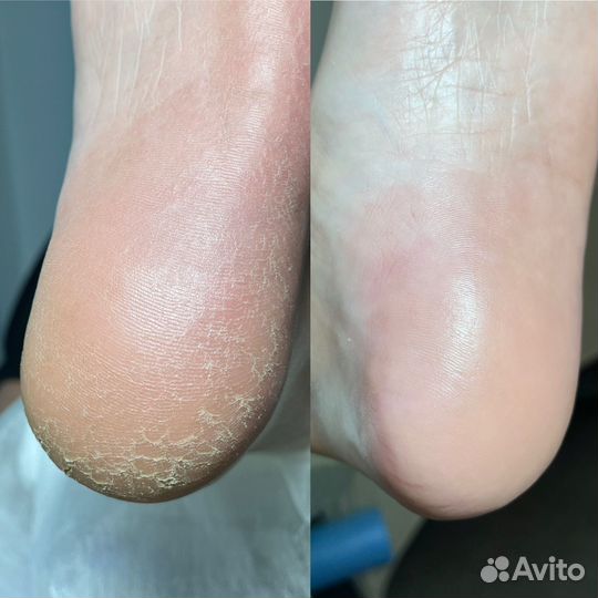 Маникюр, педикюр