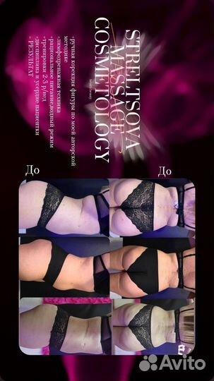 Антицеллюлитный массаж