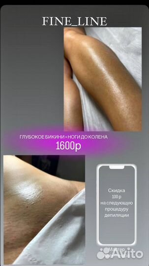 Женская депиляция
