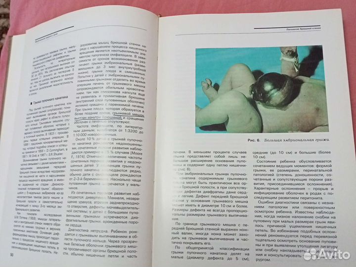 Абдоминальная хирургия у детей