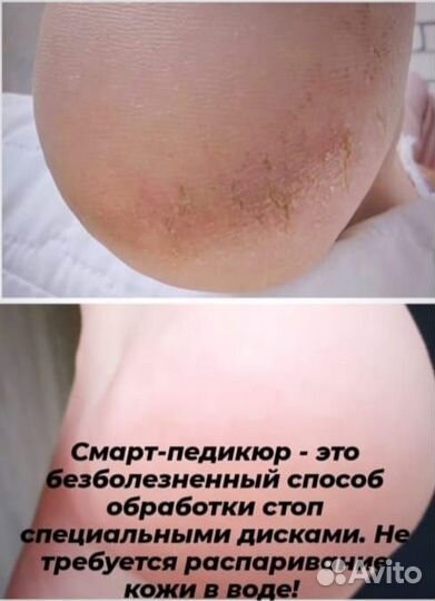 Педикюр (женский, мужской),smart-педикюр