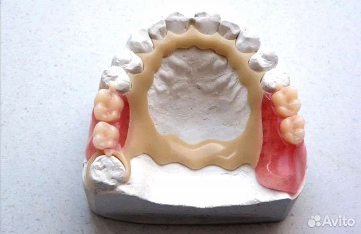 Обучение протезированию зубов для всех с нуля