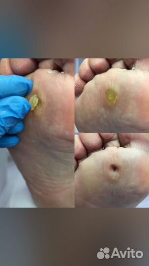 Подолог с медицинским образованием