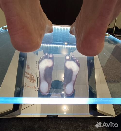 Плантоскоп (подоскоп)