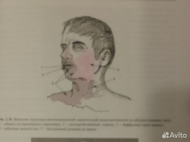 Основы семиотики заболеваний внутренних органов