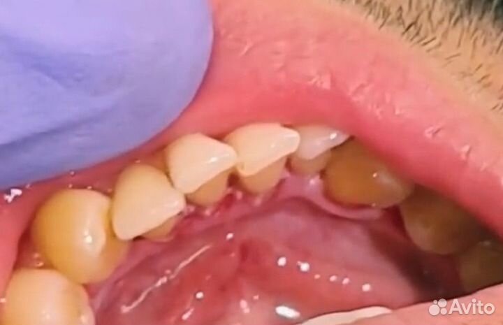 Профессиональная гигиена чистка сертификат