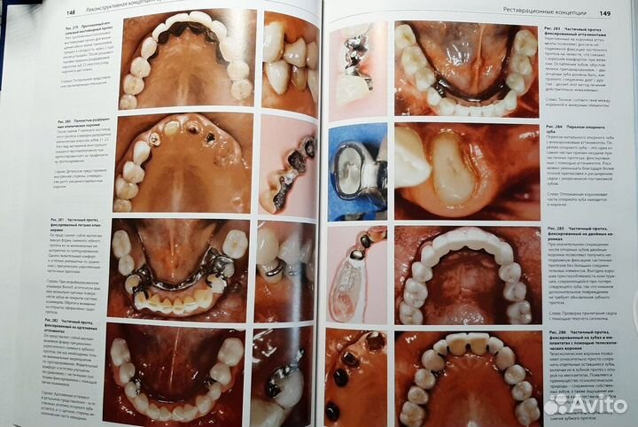 Книга стоматологии Профессиональная профилактика