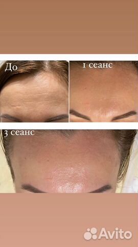 Массаж лица и тела, косметология, сжм