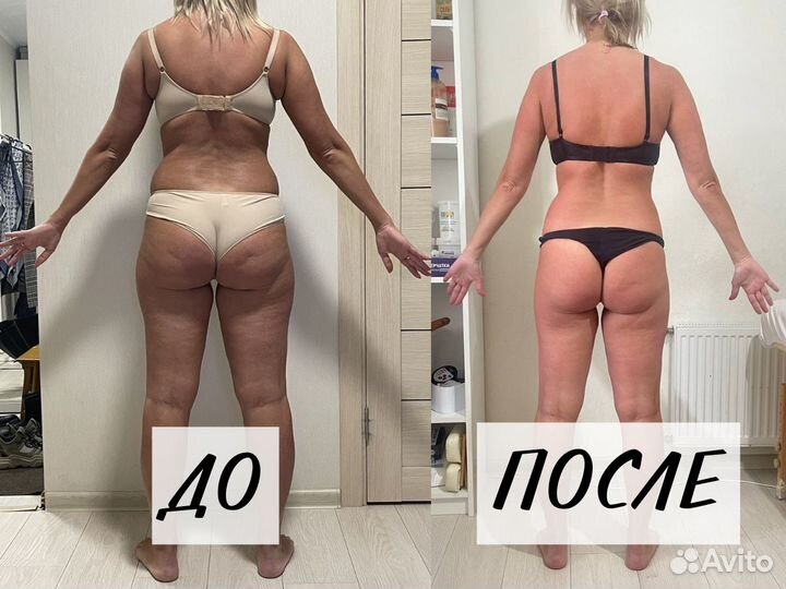 Аппаратный массаж. Антицеллюлитный массаж. Массаж