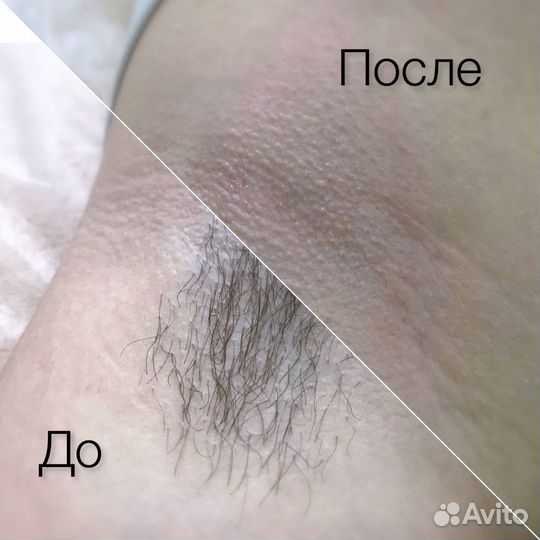 SPA шугаринг, ваксинг