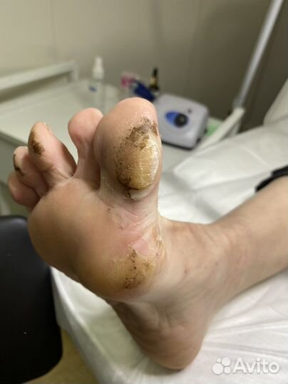 Подология, маникюр - педикюр