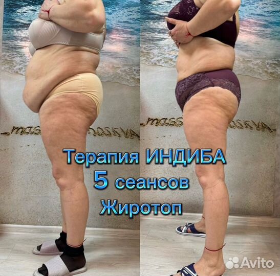 Массаж/Индиба