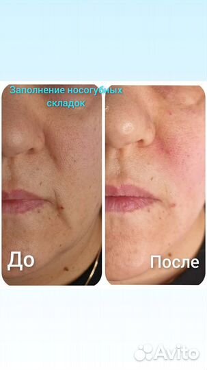 Услуги косметолога, ринопластика, липоредукция