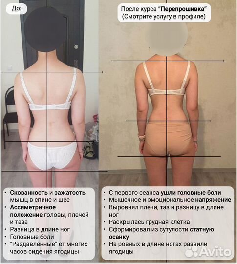 Мануальный массаж. Реабилитолог. Костоправ