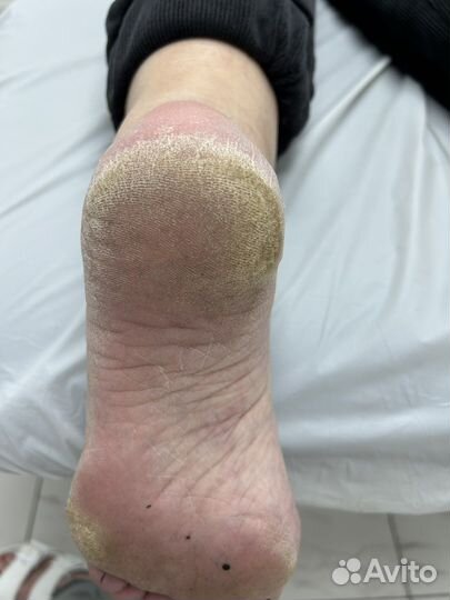 Smart педикюр