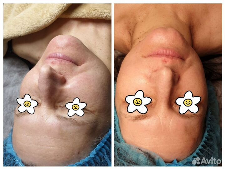 Услуги косметолога