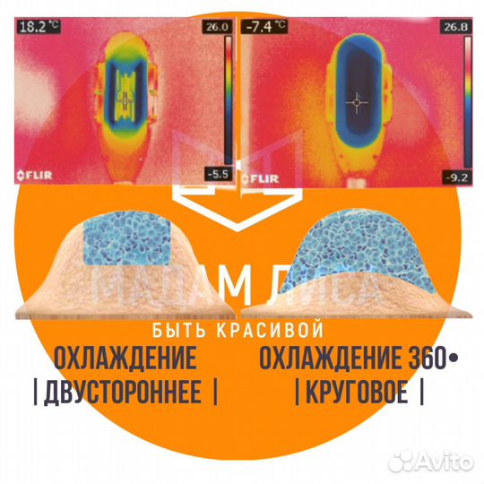 Crio 360, Криолиполиз 5 насадок,Зона подбородка