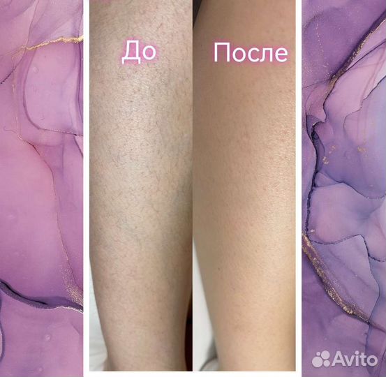 Восковая депиляция