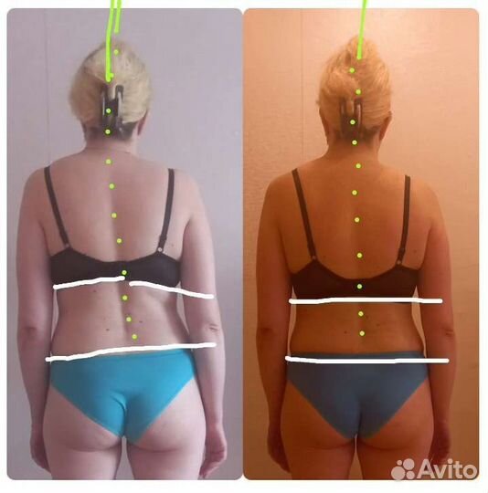 Профессиональный, оздоровительный массаж