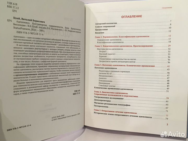 Аденомиоз. Контроль версий современности. Цхай