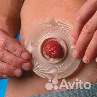 Пластина стома Alterna